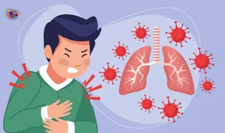 lustrasi TBC (foto : vecteezy)